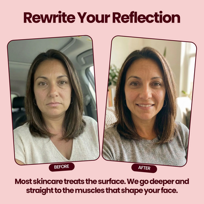 Velournis V-Roller Pro